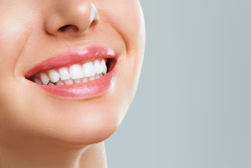 fix-sensitivity-after-bleaching-with-these-quick-tips