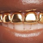 Close-Up Of Gold Grillz Covering Front Teeth For Cosmetic Dental Fashion Style